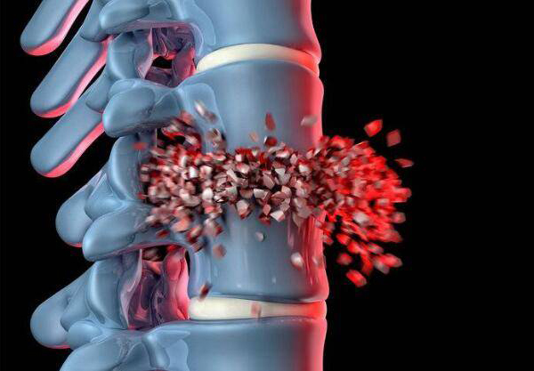 骨转移有哪些认识误区？会疼痛吗？肿瘤为何爱往骨转移呢？