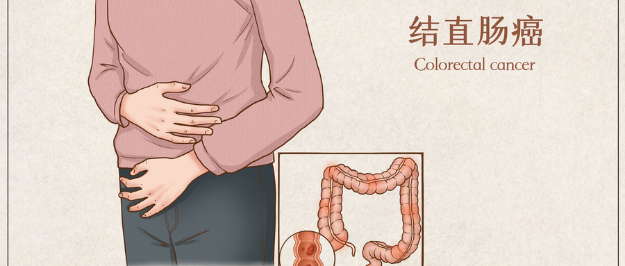 摄图网_401799663_wx_结直肠癌医疗插画（企业商用）.jpg