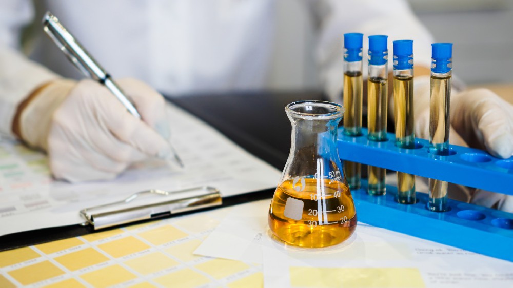 摄图网_329792637_医生将分析结果写成表格 用尿液测试管进行检查桌子液体诊所感染实验室医院治疗尿酸工作诊断（企业商用）.jpg